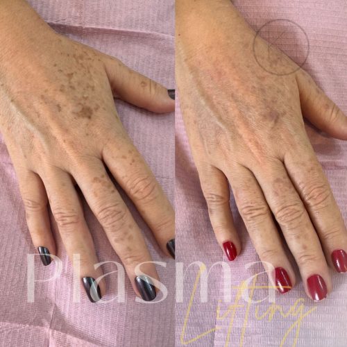 WhatsApp Image 2025-08-20 at 08.17.21