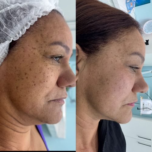 WhatsApp Image 2025-08-20 at 08.18.50