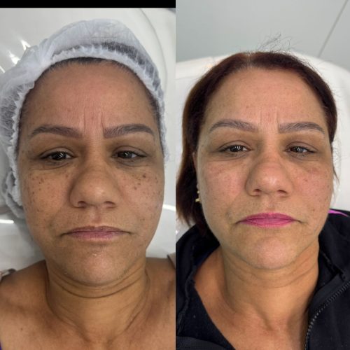 WhatsApp Image 2025-08-20 at 08.18.51